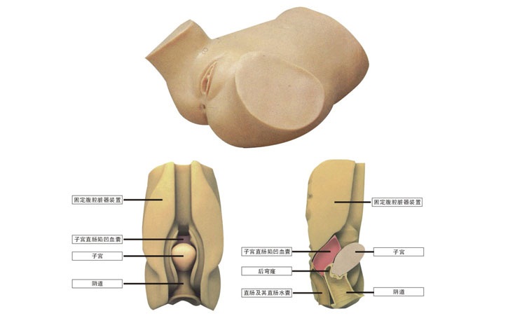 陰道后穹窿穿刺模型