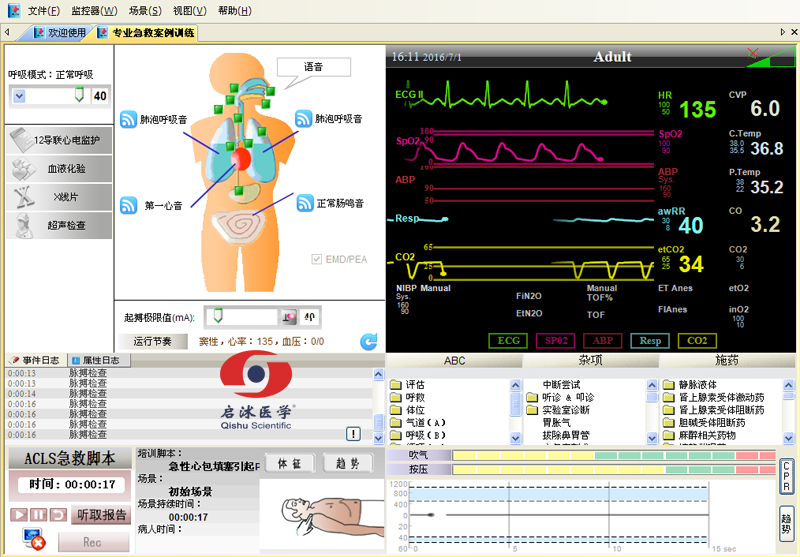  高智能數(shù)字化綜合急救技能訓(xùn)練系統(tǒng)（ACLS高級(jí)生命支持、計(jì)算機(jī)軟件控制）